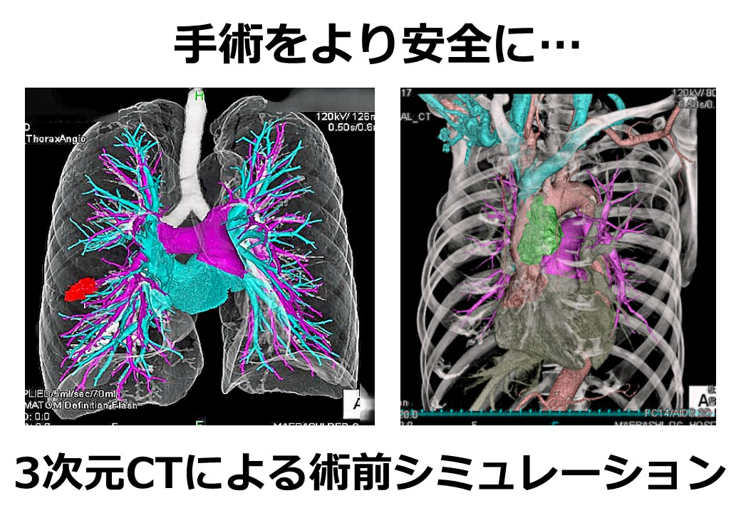 天然木を伐採せず森林資源を守る
